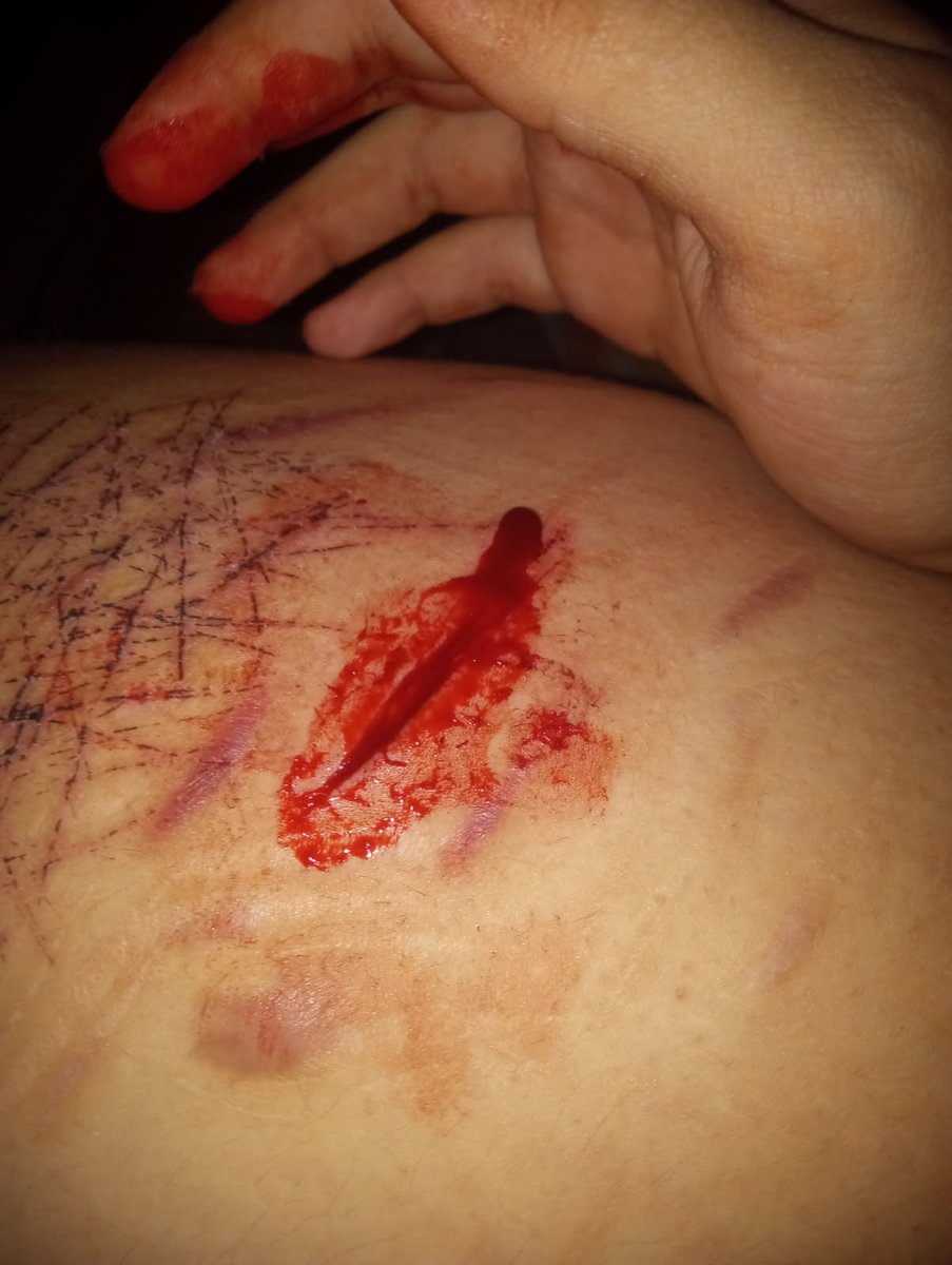 LoveSick tweet media