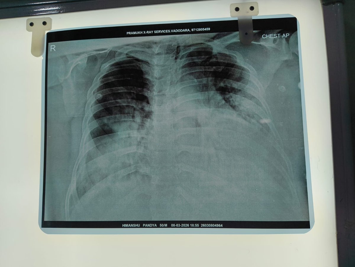 dvnsh07's tweet photo. Hey everyone 

I need your help very urgently because my father is in ICU at Gujarat, India. He is suffering from pneumonia and at Tommorow night father's oxygen level fell down to 37 so that's critical condition so we immediately take action at 1 AM (IST) mid night. https://t.co/bQ7AJmppfE