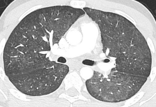 lung-dr | 呼吸器内科医 tweet media