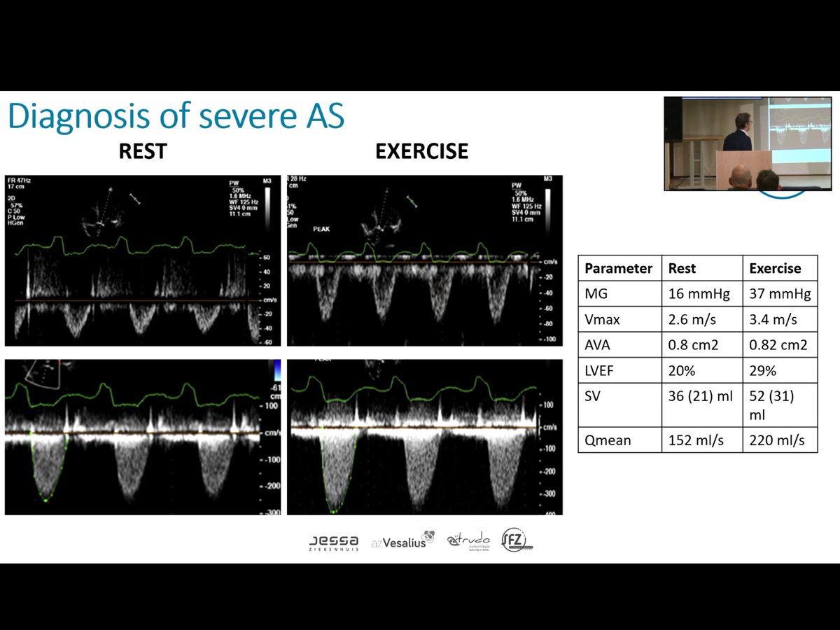 EchoTalk Echocardiography tweet media