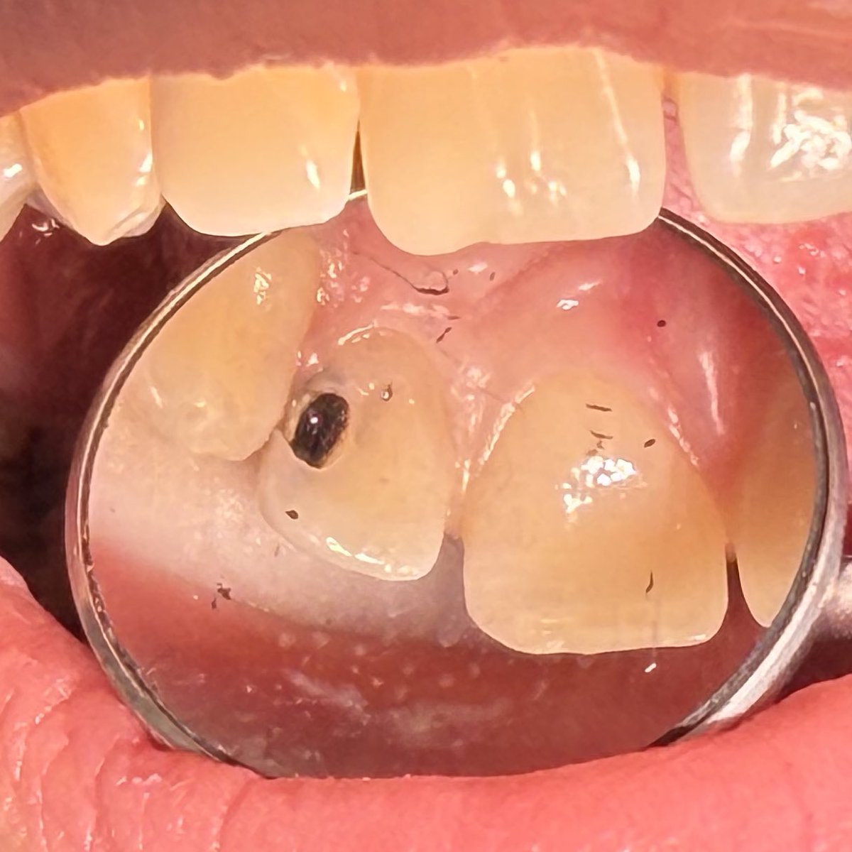sdentist4's tweet photo. Class III https://t.co/YzAJfgHelO