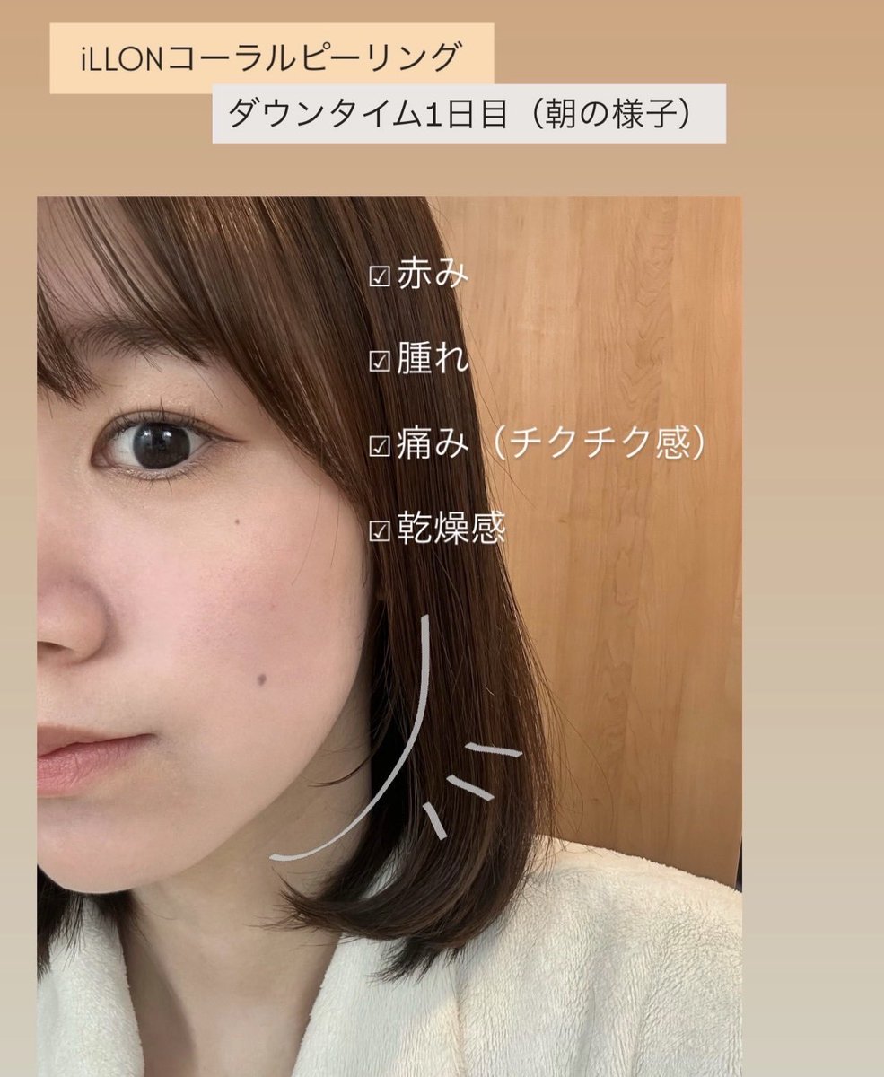 こんにちは！新宿三丁目店のsayaです☺️
先日iLLONのコーラルピーリングをしてきました！

コーラルピーリングは、
天然由来の微細な針をお肌に入れ込み、
肌の内側から再生を促すピーリング施術です。  

肌質改善を目指したい方、毛穴やニキビにお悩みの方はぜひ一度ご相談くださいませ😌