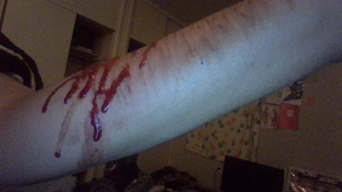 OynxStorm's tweet photo. i love bleeding so much my arm is numb now though #shedtwt #cutspo #bloodspo #scarpo #slittwt https://t.co/0hFBdU1ZGY