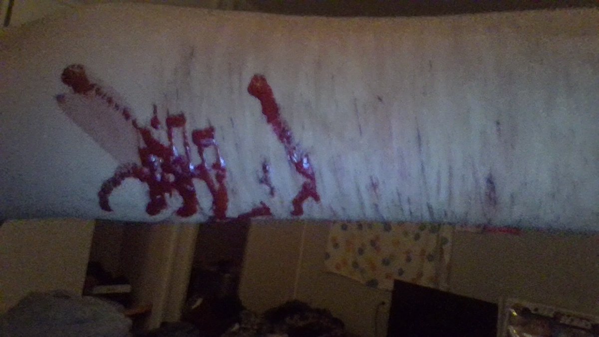 OynxStorm's tweet photo. i love bleeding so much my arm is numb now though #shedtwt #cutspo #bloodspo #scarpo #slittwt https://t.co/0hFBdU1ZGY