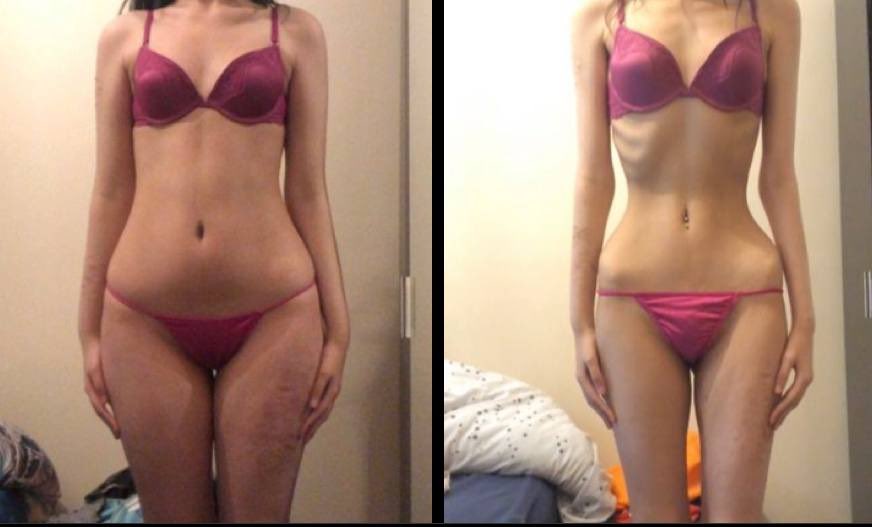 -15kg
 #thinspo #프아자극 #프아