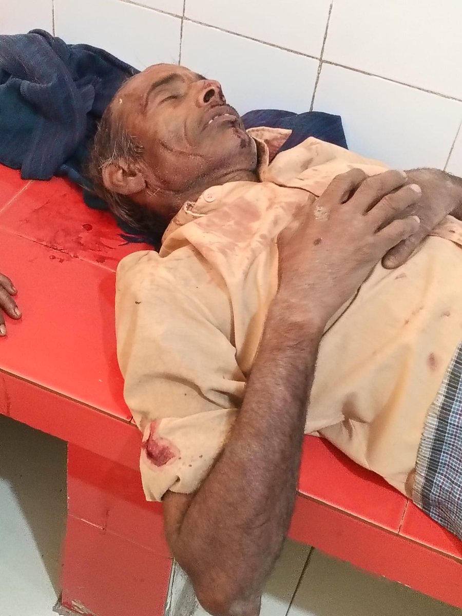 upwalegaurav's tweet photo. कानपुर मे गुंडई की पराकाष्ठा पार.!📢😡

कानपुर के साढ थाना क्षेत्र अंतर्गत चिल्ली गाँव मे गुंडों ने कुशवाहा समाज के 8 लोगों को पीट पीटकर अधमरा कर दिया जिसमें कई के सिर फट गए हाथ पैर टूट गए है.!

पूरा मामला खेत में पानी लगाने को लेकर हुआ है ऐसा बताया जा रहा @kanpurnagarpol
से निवेदन है कि मामले पर सख्त से सख्त कार्यवाही सुनिश्चित करे.! 

@Uppolice | @dgpup | @adgzonekanpur