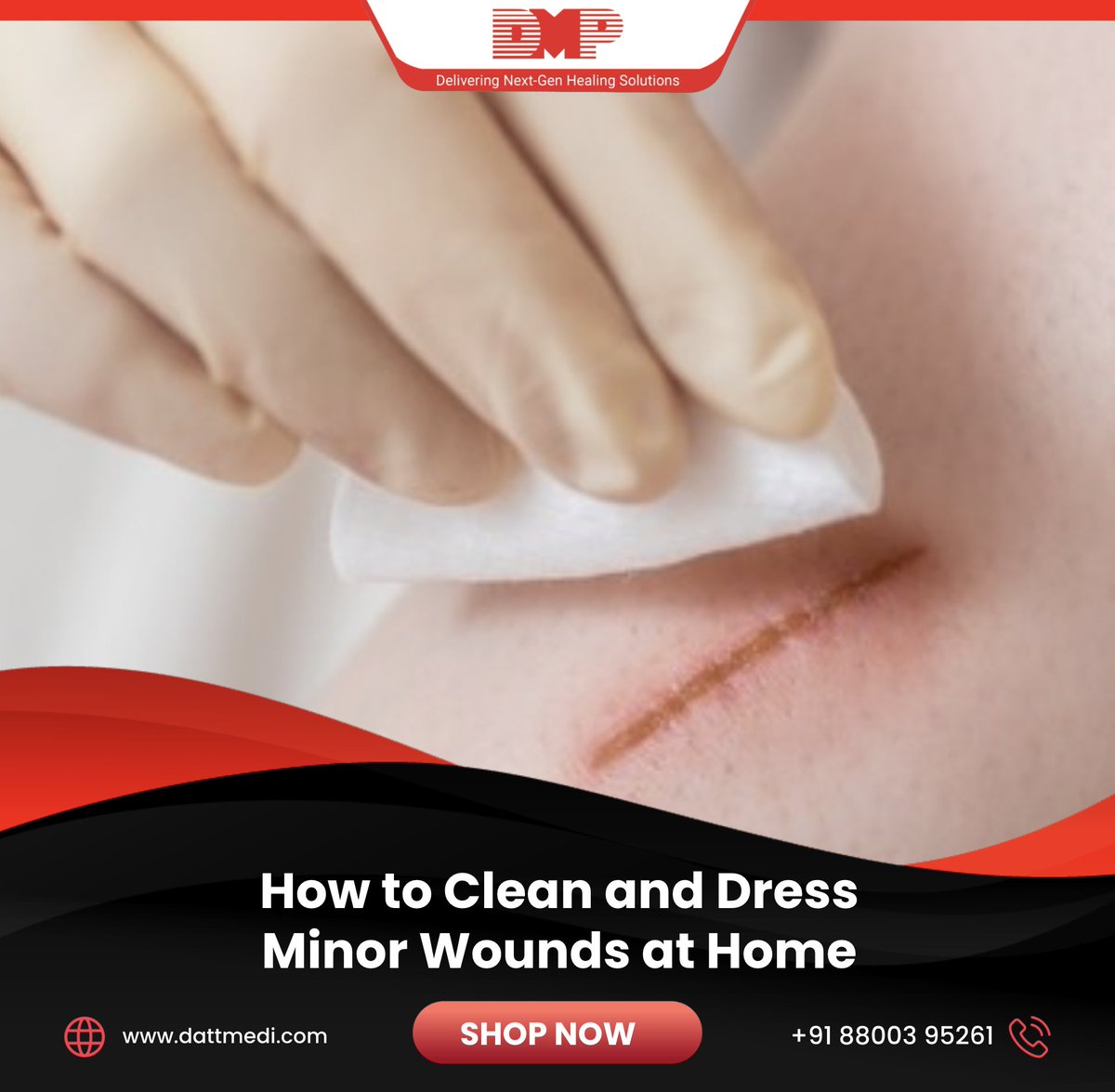 dattmediproduct's tweet image. 🩹 Taking care of minor wounds at home is easy with the right steps! ✅

Proper cleaning &amp;amp; dressing prevent infection, reduce pain, &amp;amp; speed healing.✨ Need help? Check out our blog for a simple, step-by-step guide 👉 bit.ly/48NRqwj 
.
.
#WoundCareBasics #FirstAidTips