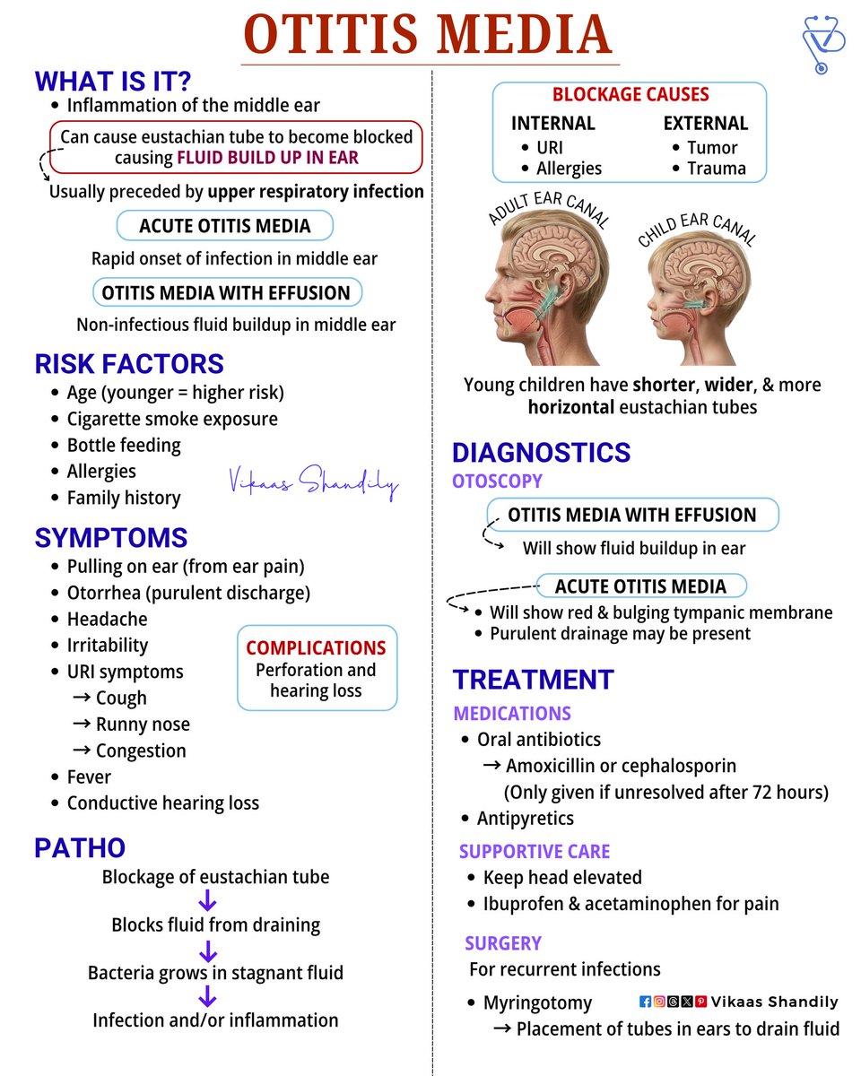 VikaasShandily's tweet image. Otitis Media: Causes, Symptoms, Diagnosis &amp;amp; Treatment
#Pediatrics #OtitisMedia #Medical #Nursing #VikaasShandily