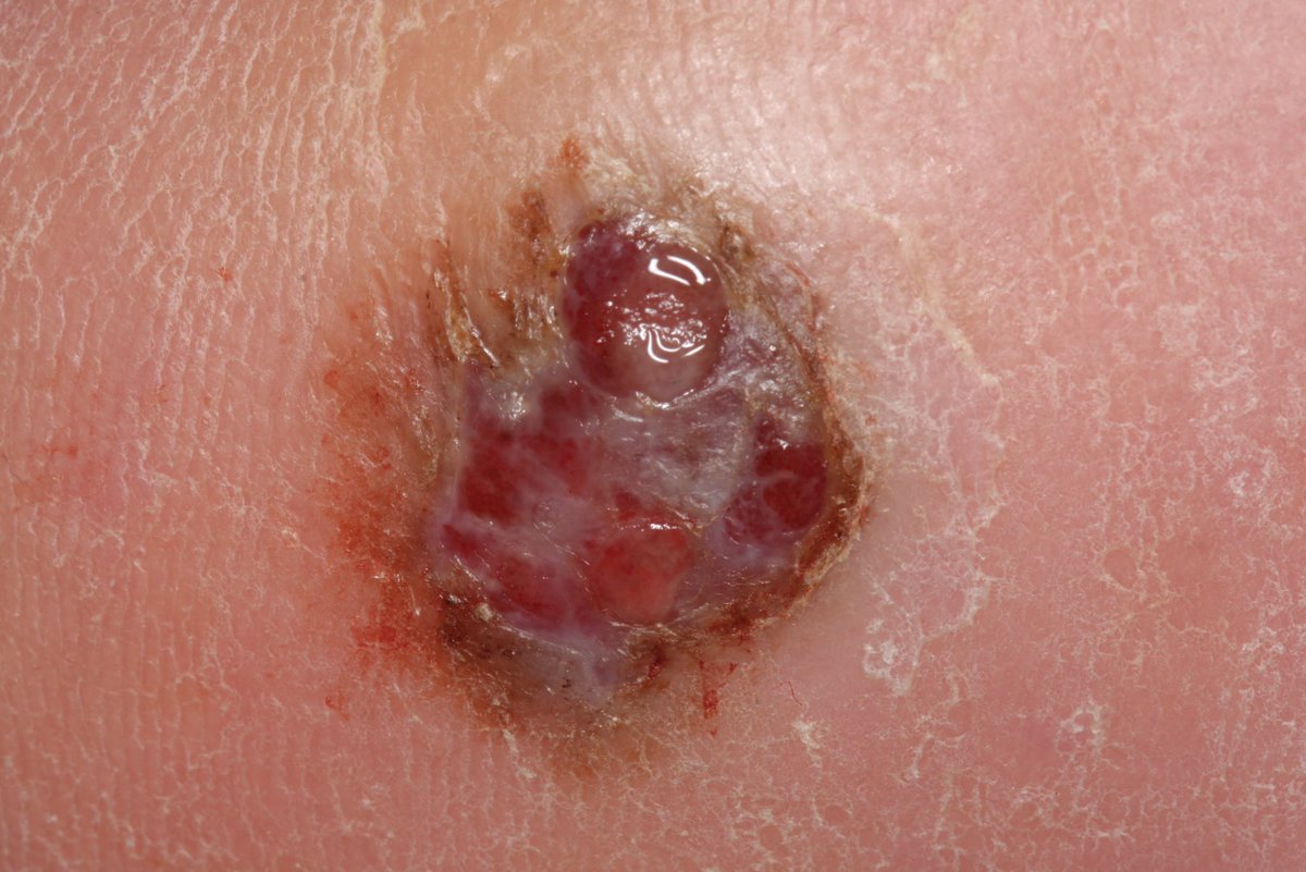 Dermatopoulos tweet media