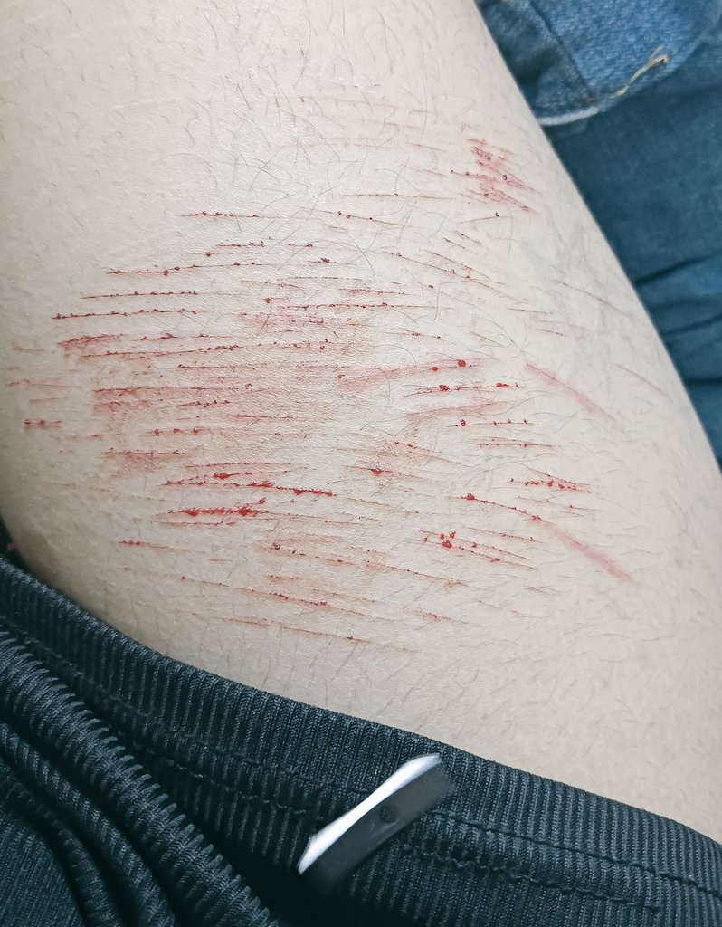 Noli ۫ ׅ ✧ tweet media