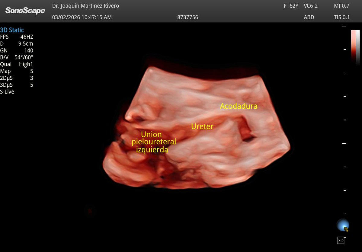 Joaquín Martínez tweet media