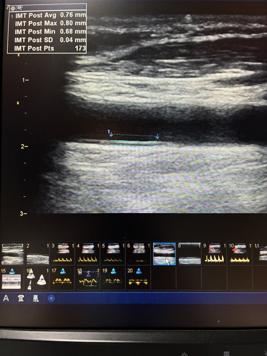 EchoTalk Echocardiography tweet media