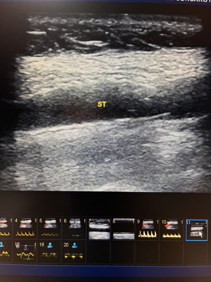 EchoTalk Echocardiography tweet media