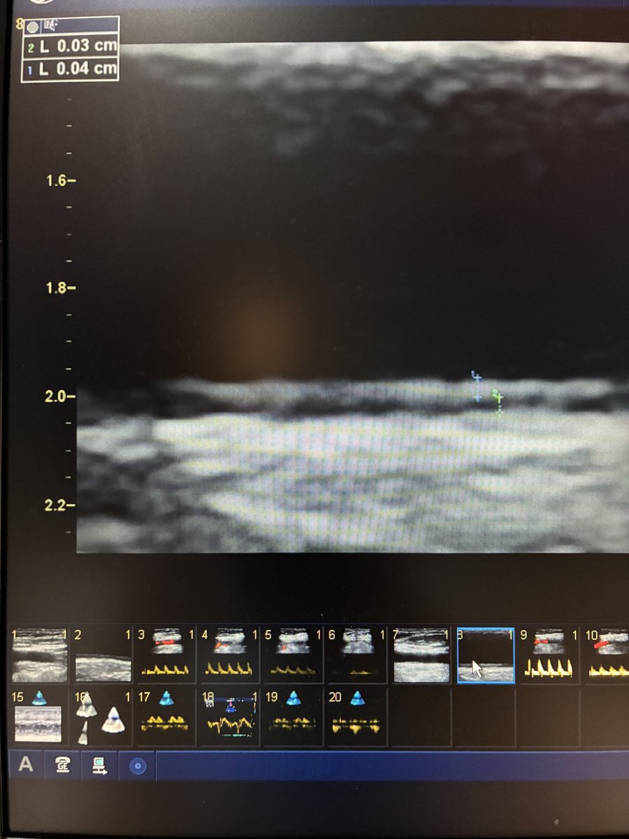 EchoTalk Echocardiography tweet media