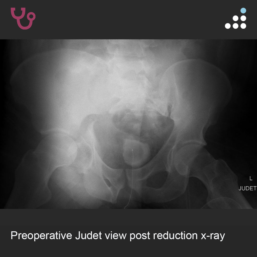 Orthobullets tweet media