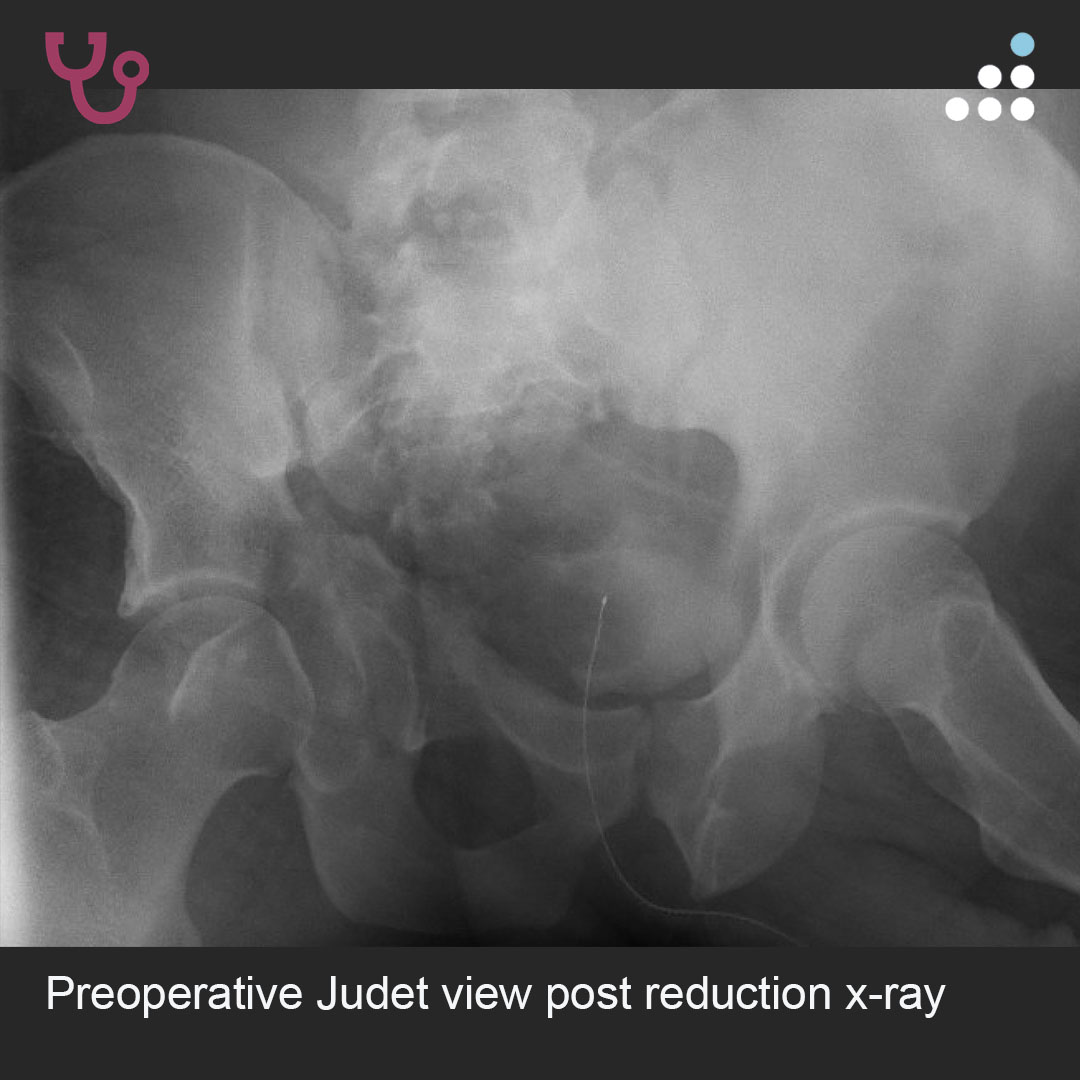 Orthobullets tweet media