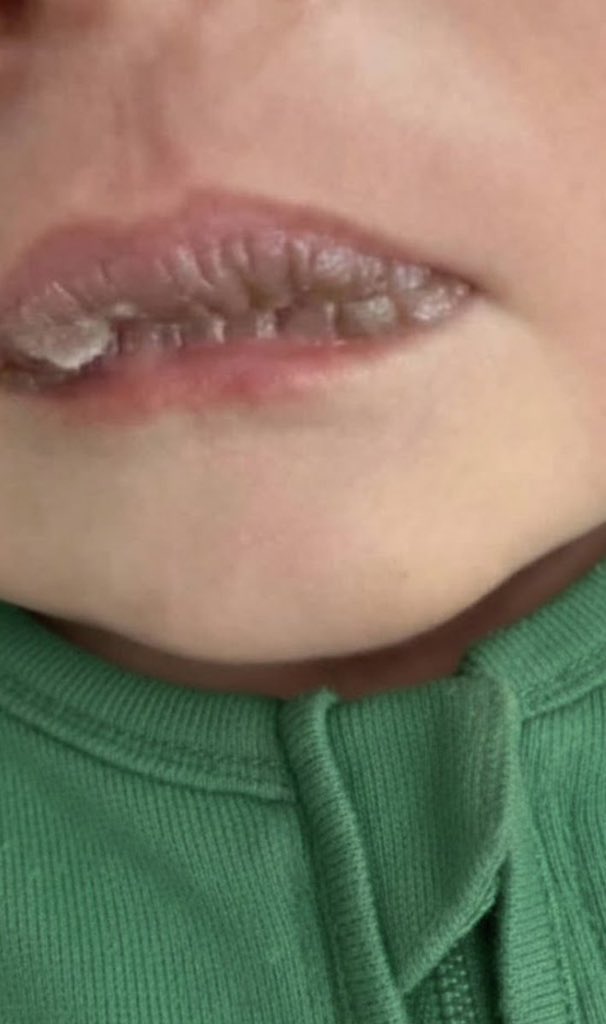 I will not forgive anyone who sees this post and does not support me with a single word and ignores me.

If you see this, leave even a dot

gofund.me/5a695682c
Chuffed 
chuffed.org/project/141230