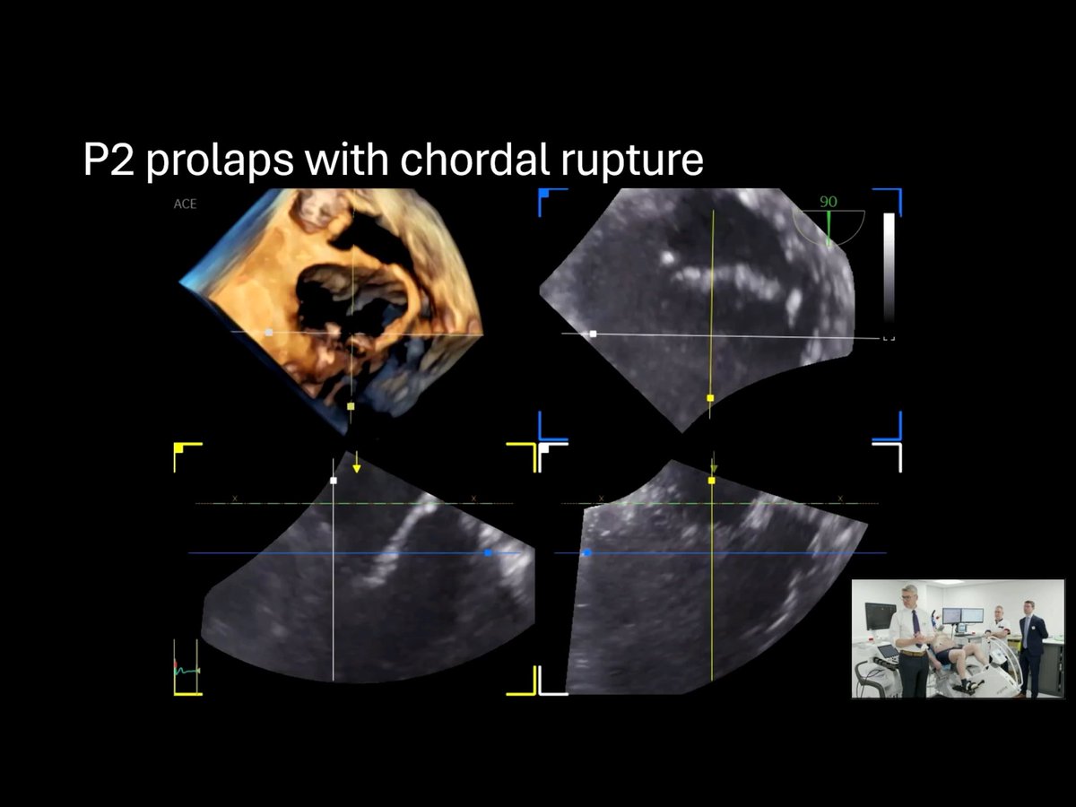 EchoTalk Echocardiography tweet media