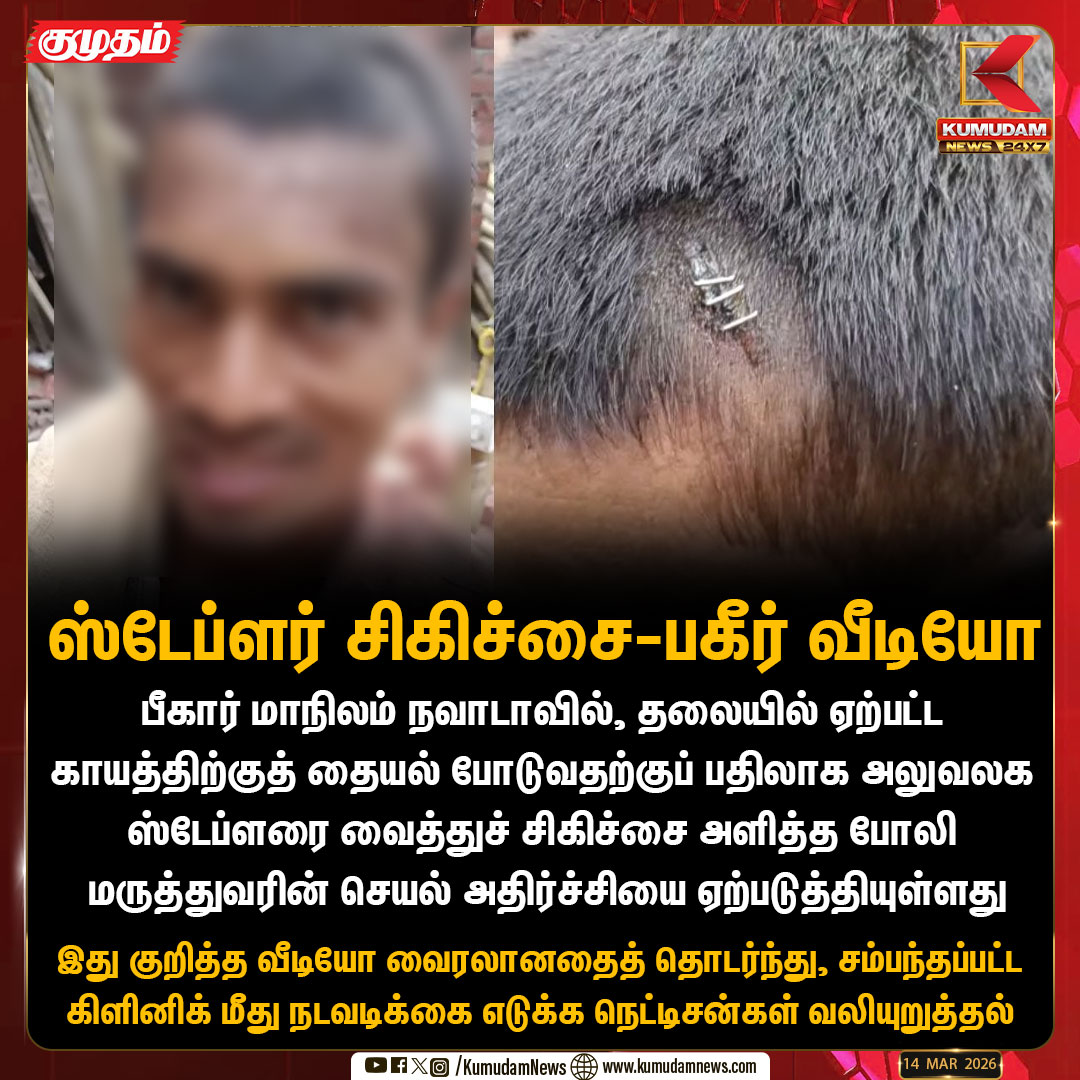 kumudamNews24x7's tweet image. ஸ்டேப்ளர் சிகிச்சை-பகீர் வீடியோ  

 #Bihar | #stapler | #Kumudamnews24x7 | kumudamnews.com