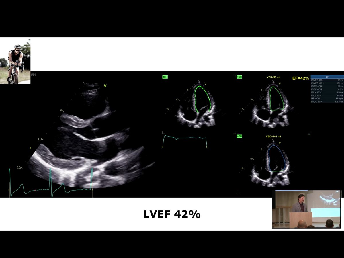 EchoTalk Echocardiography tweet media