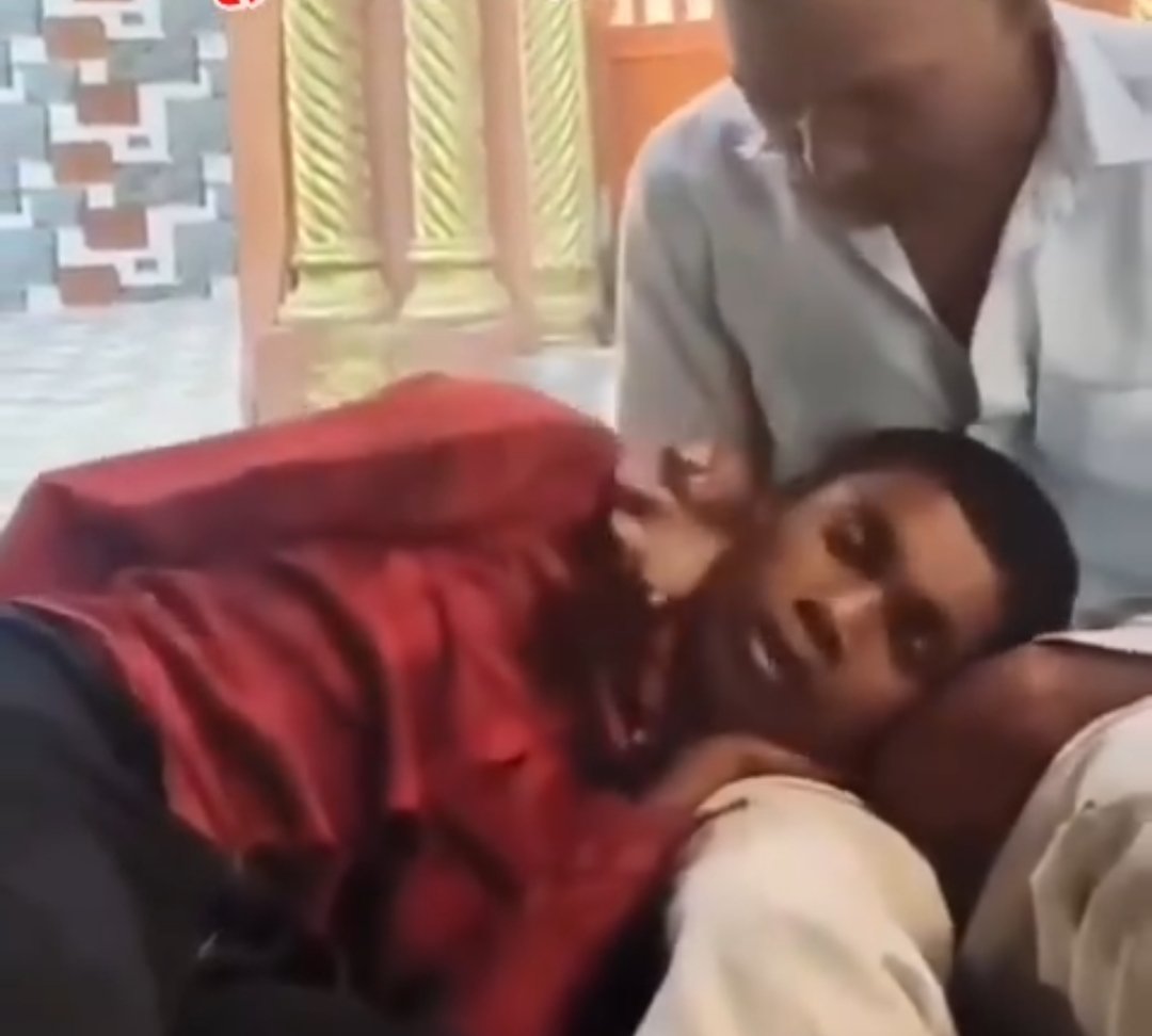 लाल शर्ट पहने हुए दिखाई दे रहे इस बच्चे को आज से 4 महीने पहले एक कुत्ते ने काट लिया था...

पिता दिव्यांग था, इसलिए अपने बेटे को रेबीज के पूरे इंजेक्शन नहीं लगवा पाए, केवल 2 ही इंजेक्शन निजी अस्पताल में लगवाए थे।
समय हंसी खुशी बीत रहा था, समय बिता शायद वो आने वाले खतरे को भूल भी