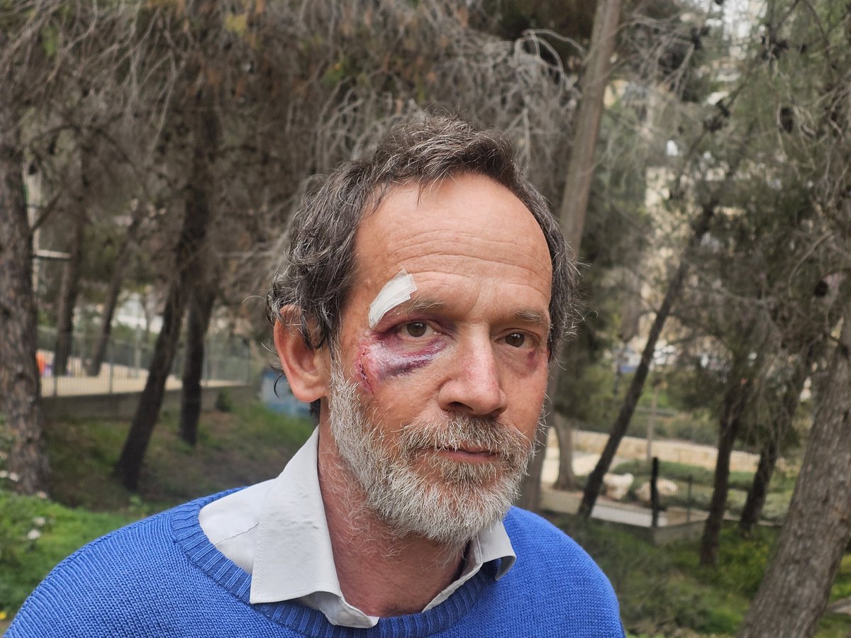 نير حسون Nir Hasson ניר חסון tweet media