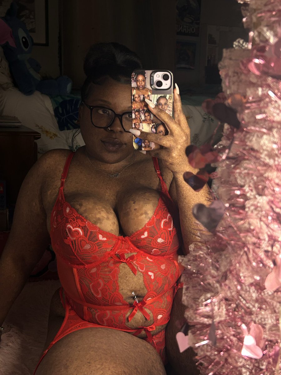 ℕ𝕦𝕣𝕤𝕖 𝔽𝕚𝕠𝕟𝕒🥹❤️💕💋 tweet media
