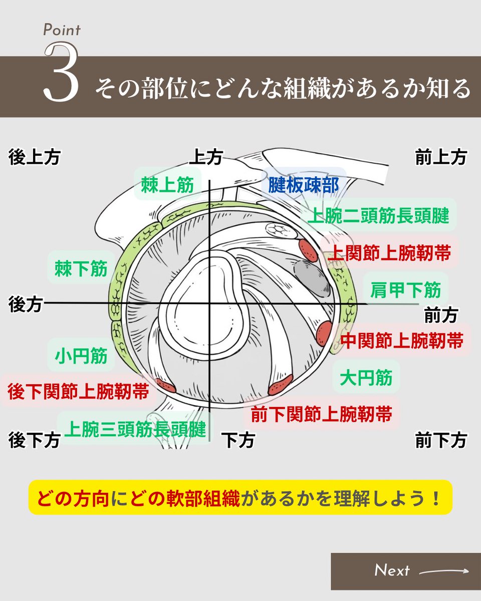 obuchi_shoulder's tweet photo. 【保存版：肩関節の制限因子マップ】

「どの方向にどの組織があるか、覚えられない…」

そんな悩み、この投稿1枚で解決します。

① まずは基本のLPPを知る
② 動かした方向の「逆側」を疑う
③ その部位にある軟部組織を特定する

明日からの臨床で活かしてみてください！

https://t.co/mePtZ7hrjt https://t.co/y6sYkj2IhM
