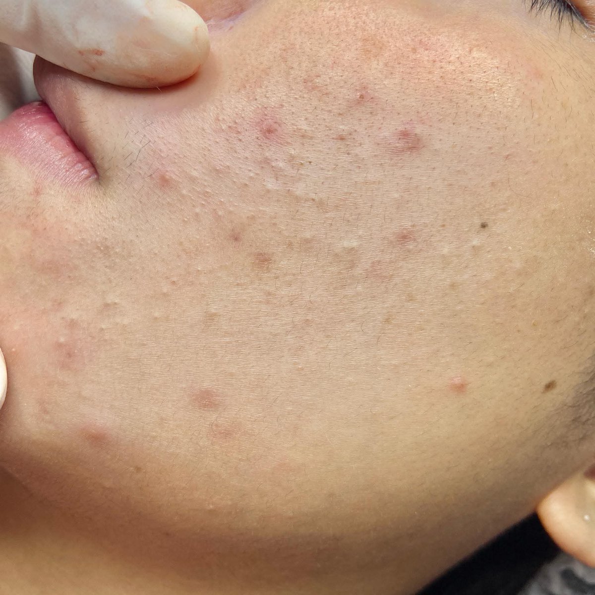 ก่อนจะสามสิบ tweet media