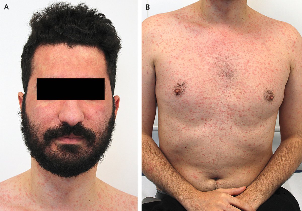 Med Mutant tweet media