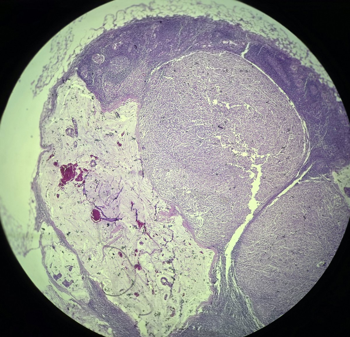 aung phyo tweet media