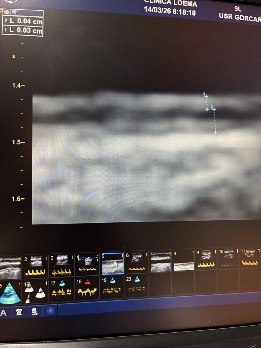 EchoTalk Echocardiography tweet media