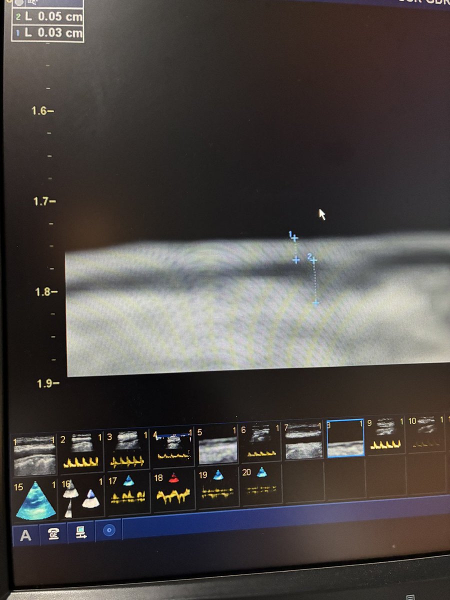 EchoTalk Echocardiography tweet media