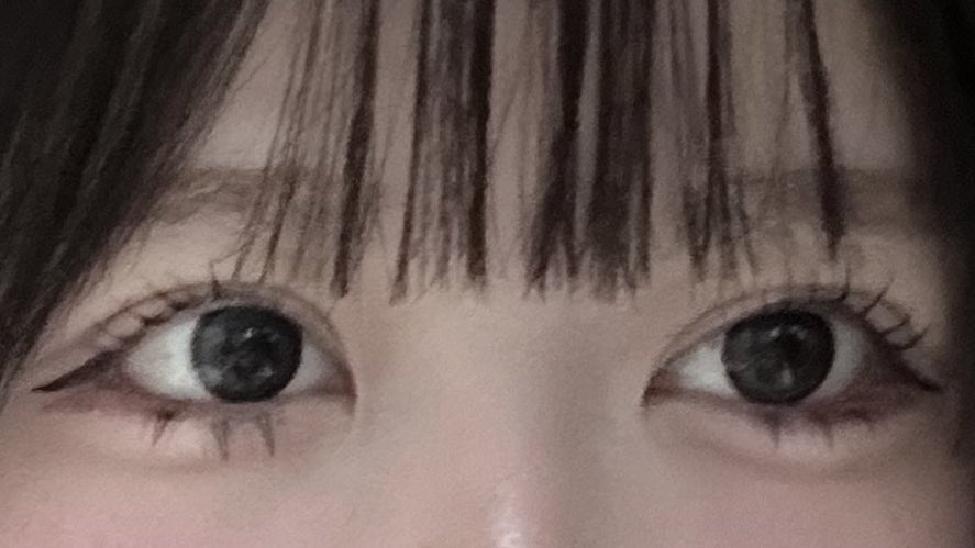 dpsnll's tweet photo. 蒙古襞の食い込み無くしたくて目頭整形したけど、蒙古襞の食い込みしてないけどこれは何したらいいんだろう、目頭再手術？ https://t.co/MyGqgmPJUS