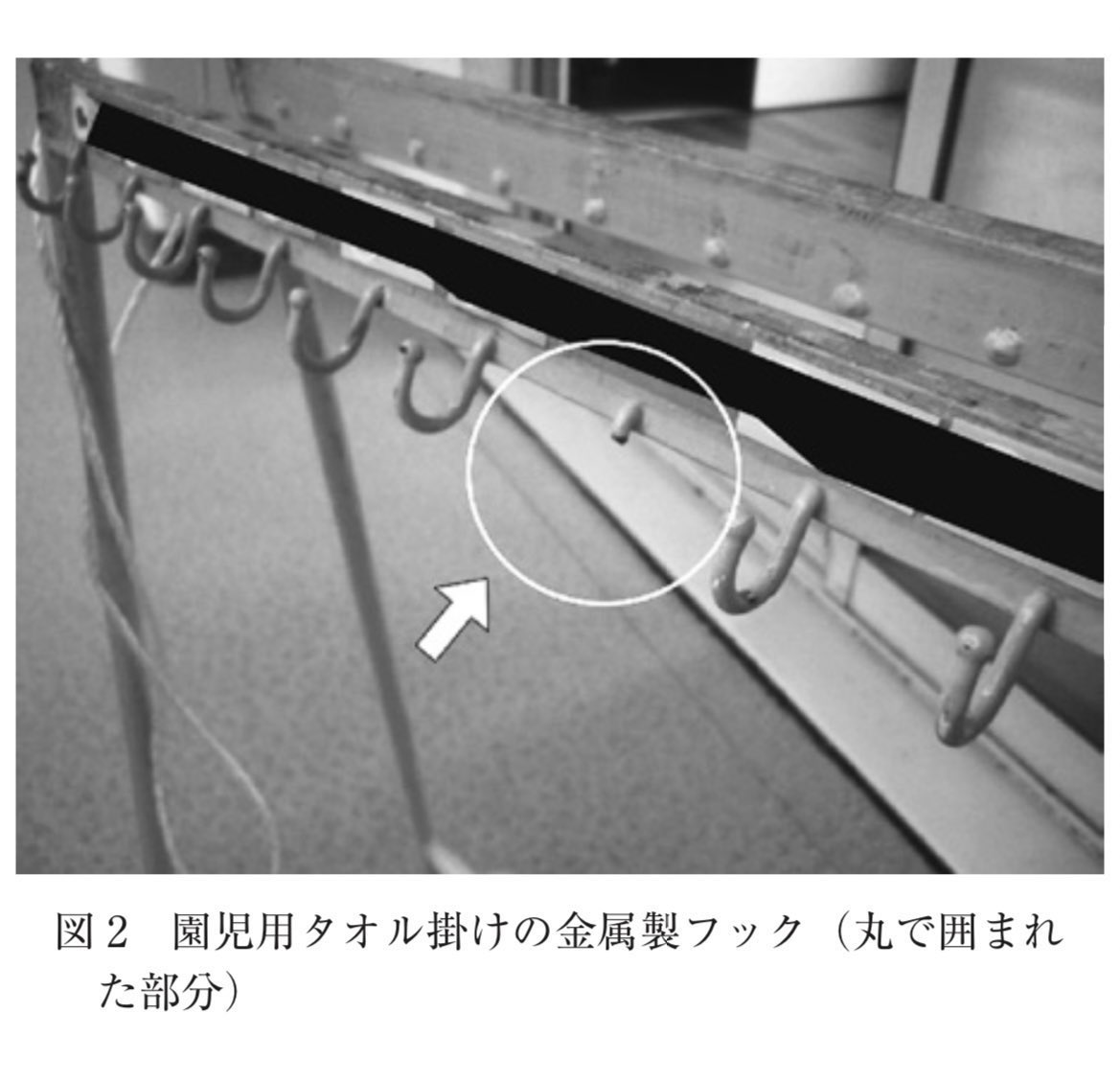 Shiba_kids's tweet photo. #InjuryAlert【金属製のフックによる眼瞼裂創】
5歳児。保育園のテラスにいた。
タオル掛け下部の金属バーに足を乗せて揺らして遊んでいたところ、バランスを崩して転倒した。
物音を聞いた保育士が、患児の左眼裂から上眼瞼にフックが貫通した状態で倒れているのを発見し、医療機関へ救急搬送された。 https://t.co/NzAtWlQVUj