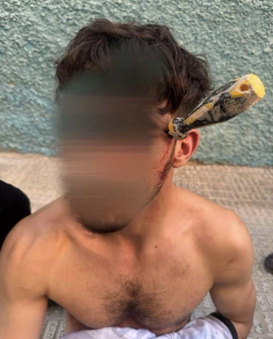 🇪🇸 Un magrebí herido GRAVE con un destornillador en la cabeza tras una reyerta en Alicante