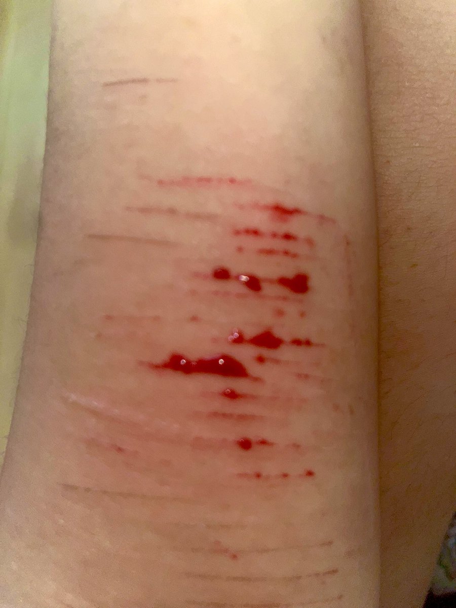 🍫 𝒸yn ♡’s 𝓂ello (SHEDTWT) 🪽 tweet media