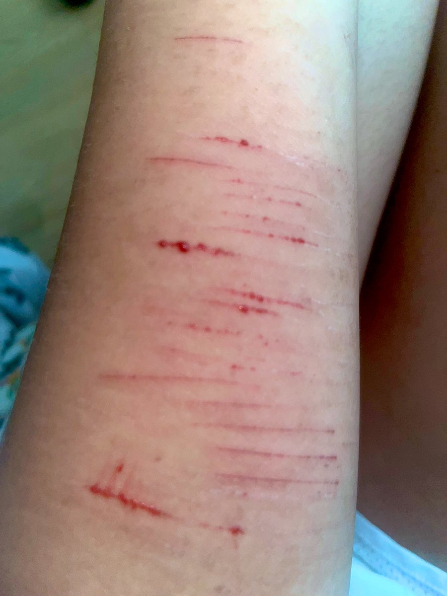 🍫 𝒸yn ♡’s 𝓂ello (SHEDTWT) 🪽 tweet media