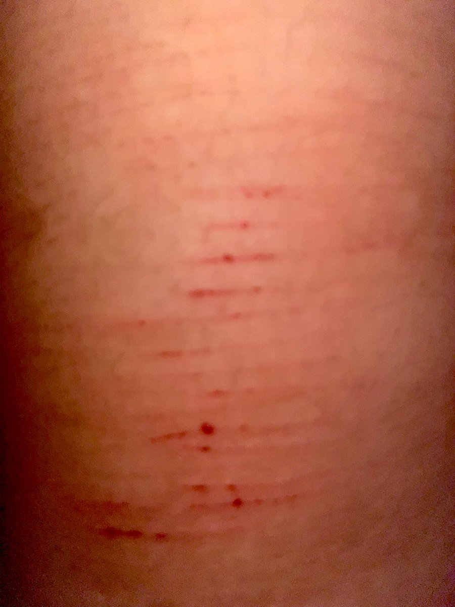 🍫 𝒸yn ♡’s 𝓂ello (SHEDTWT) 🪽 tweet media