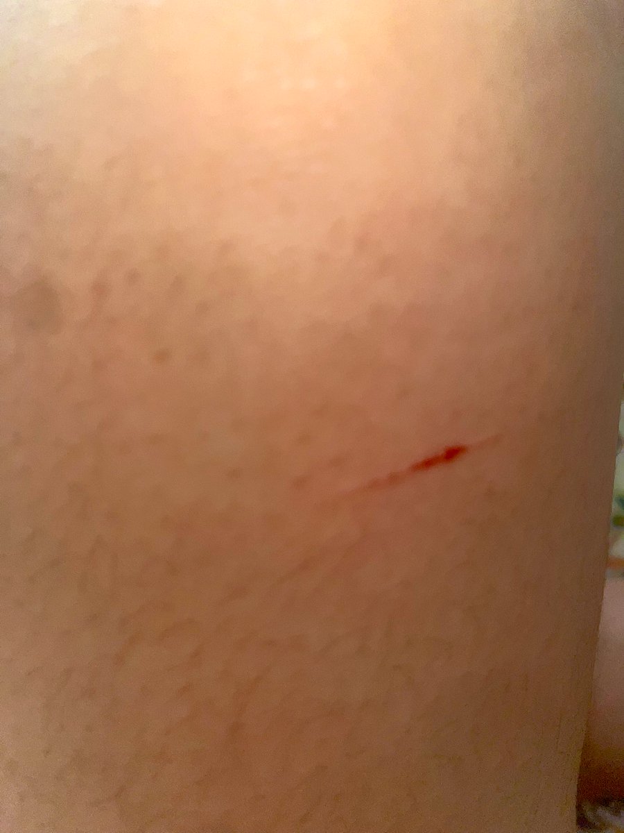 🍫 𝒸yn ♡’s 𝓂ello (SHEDTWT) 🪽 tweet media