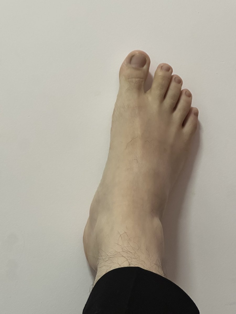 坏毛病很多 tweet media