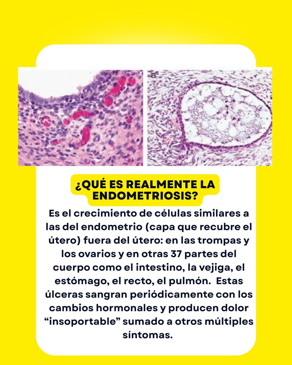 ALIANZA DE PACIENTES URUGUAY tweet media