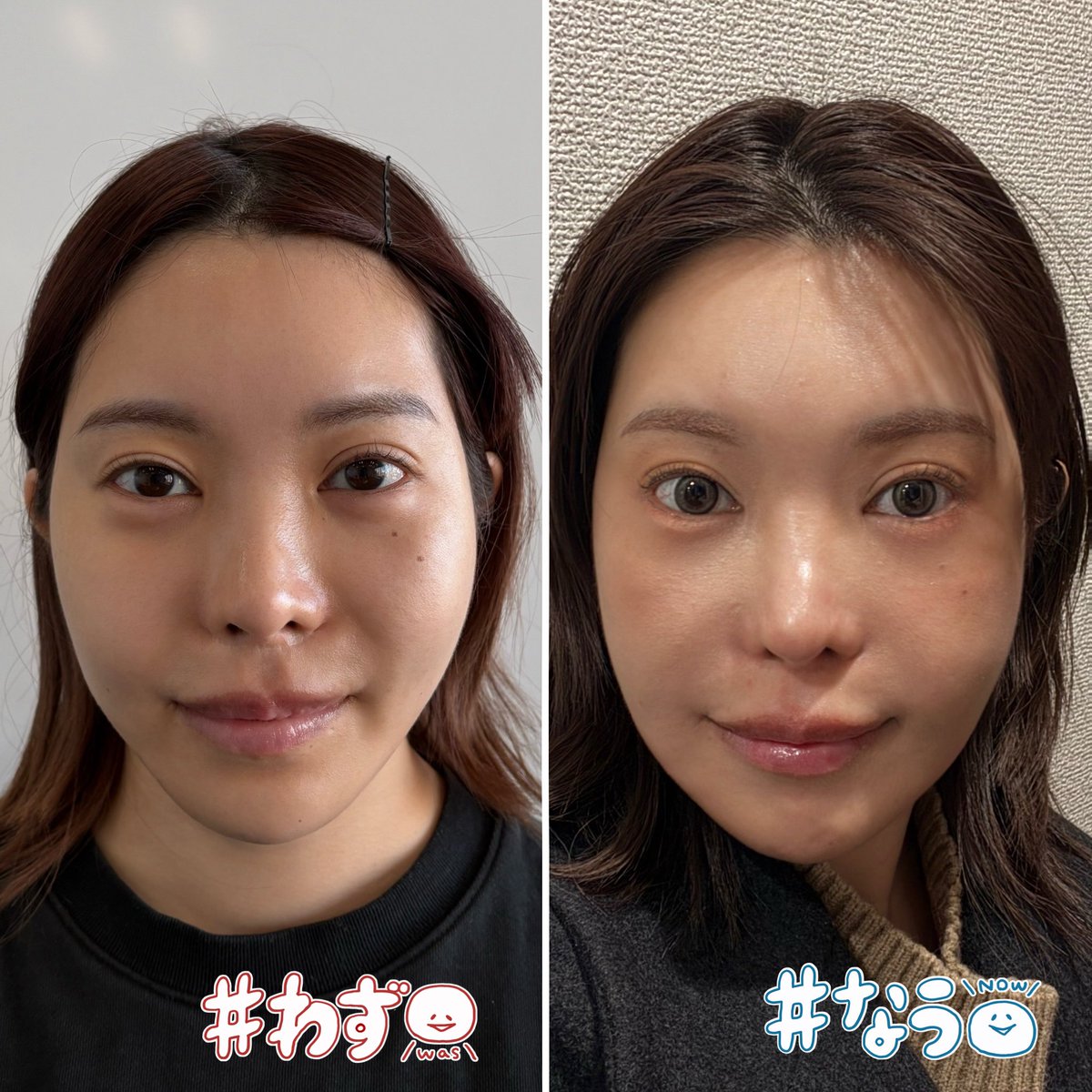 はげまして成宮 tweet media