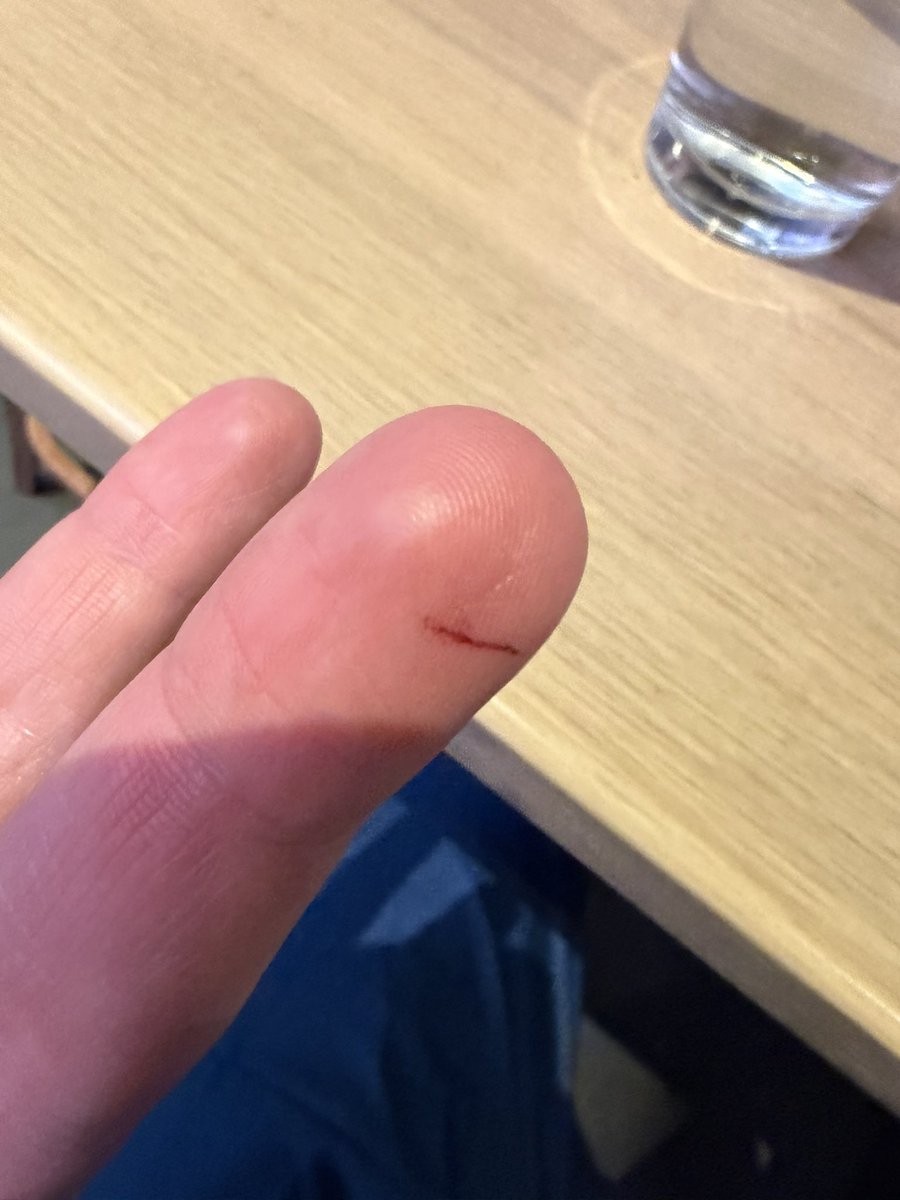 About to start slot golf and got a terrible injury. This will be my ...