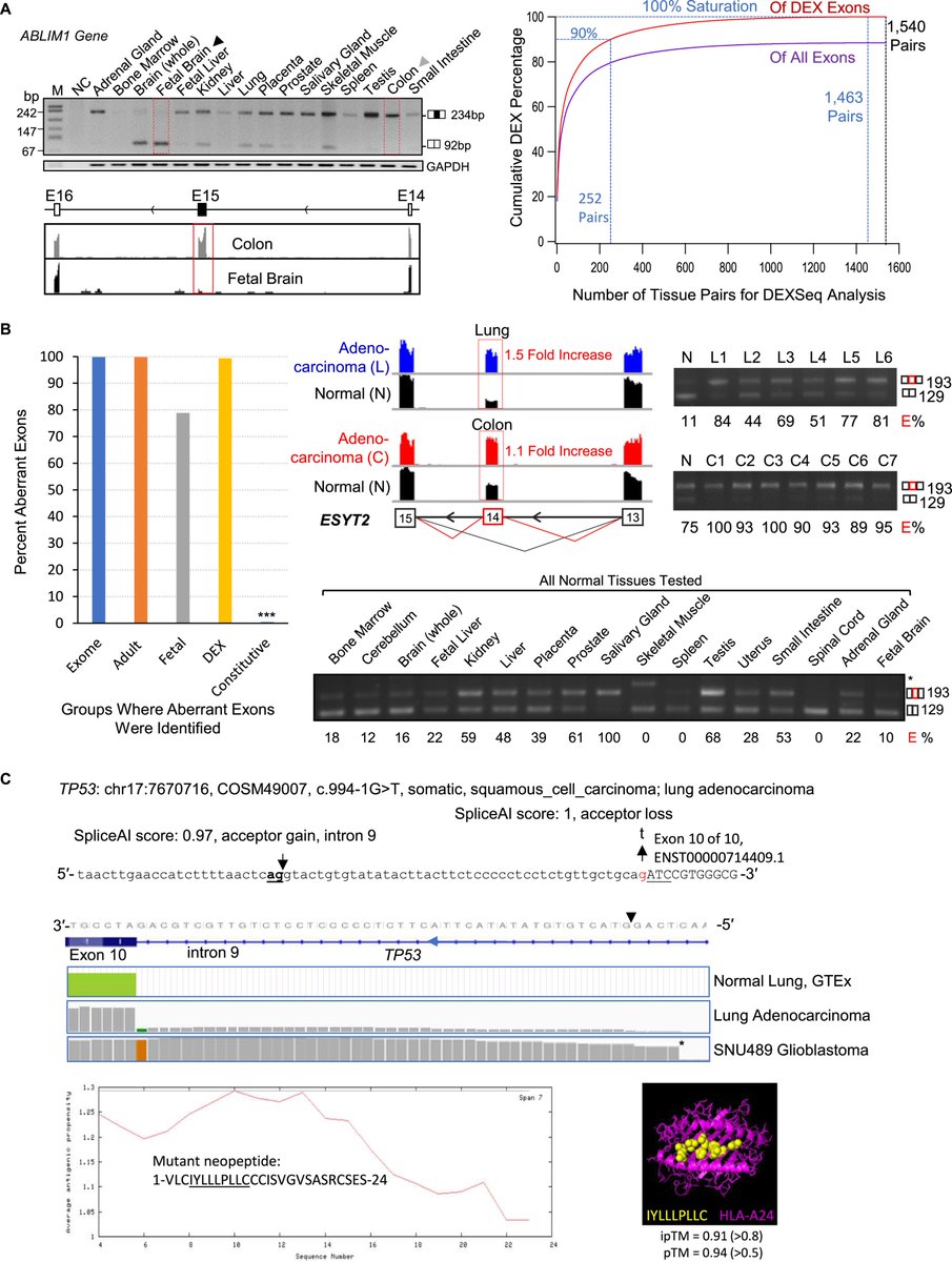 ur_mi_das's tweet photo. New paper is out!! 🎉 
“Highly restricted specificity of aberrant exons in a saturated background of differentially expressed exons.” 

Read here: https://t.co/VxpPN9XhhV

#Transcriptomics #RNAseq #Splicing #Aberrantexon #Specificity #Cancerresearch https://t.co/Bnln2cEpCW
