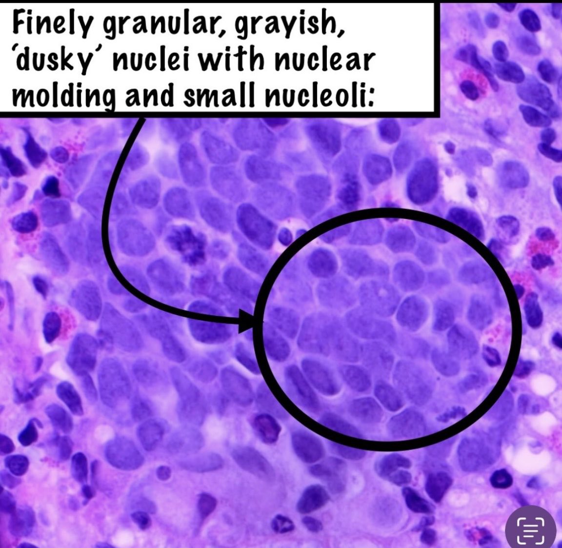 Brown Pathology and Laboratory Medicine tweet media