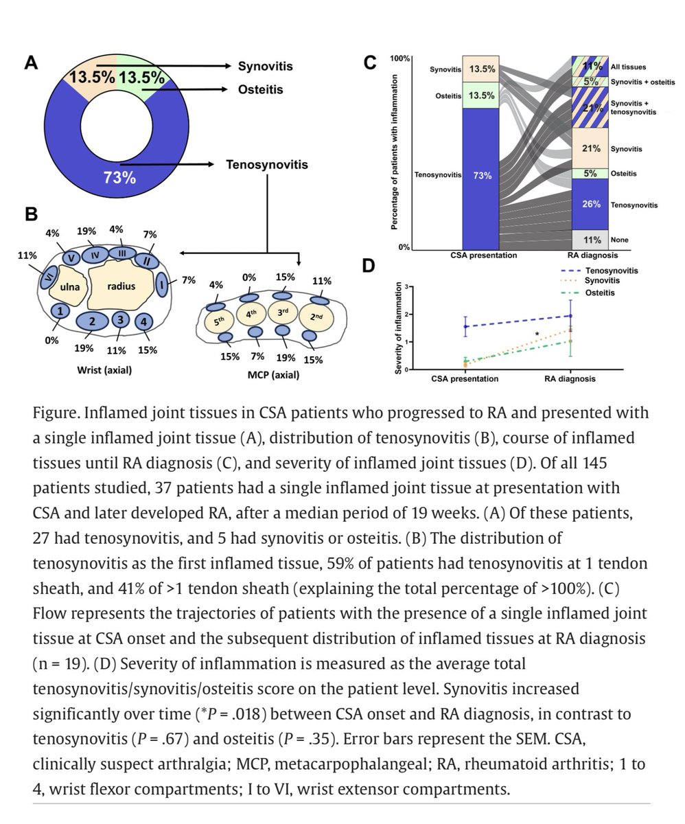 alb_giraldo's tweet image. A recent study on the etiopathological trajectory of #rheumatoid #arthritis (RA), based on the largest MRI study to date in patients with clinically suspected arthralgia (CSA) who progressed to RA provide the first suggestive evidence for the notion that joint #inflammation