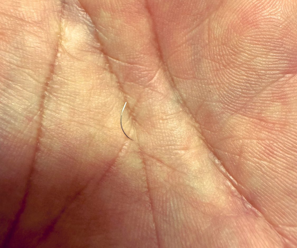 一日中お尻がチクチクしてたんですが、あの日練習中に生き別れた8-0プロリンとパンツの中で再開しました