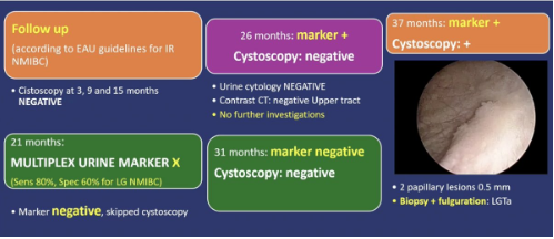 UroToday.com tweet media