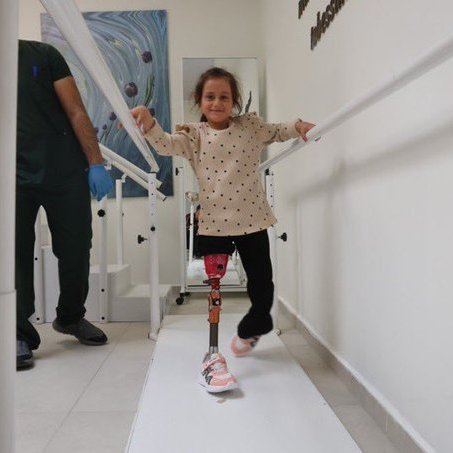 solcugazete60's tweet photo. Anne, baba ve dört kardeşini 6 Şubat depremlerinde kaybeden 7 yaşındaki Zeynep, Barbie çıkartmalı protez bacağıyla hayata yeniden tutunuyor. https://t.co/IUdID64MX4